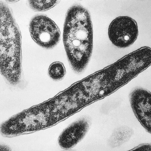 O que é a doença dos legionários, infecção que já matou duas pessoas e infectou mais de 70 em surto em Nova York