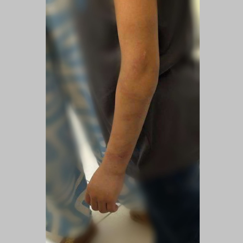 Mãe presa admite que agrediu filha de 9 anos com vários golpes de vassoura por não cumprir tarefa doméstica, diz polícia