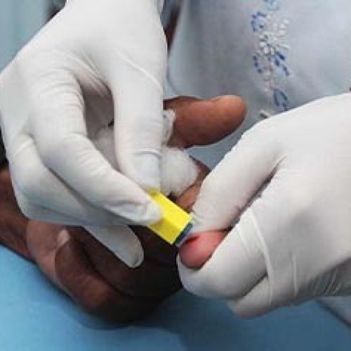 Programa de IST/Aids oferece testes gratuitos e sigilosos em Macaé
