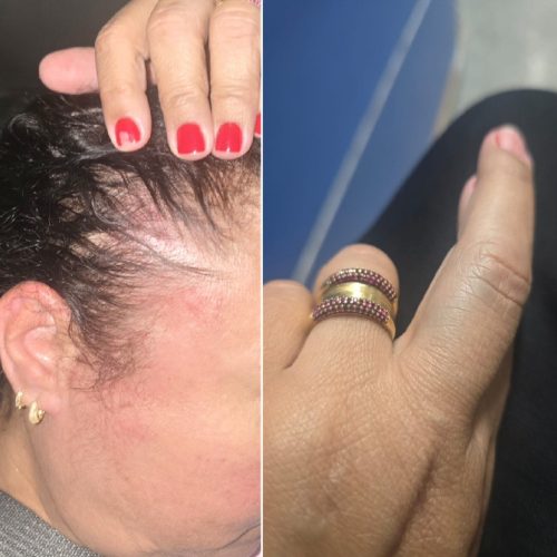 Mulher acusa genro, policial militar, de agressão durante aniversário do neto em Iguaba Grande